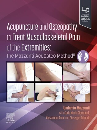 Acupuncture and Osteopathy to Treat Musculoskeletal Pain of the Extremities - E-Book
