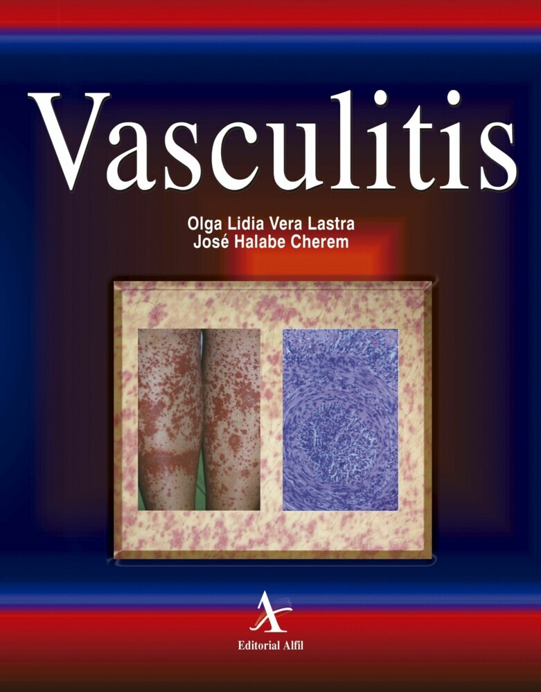 Vasculitis main product photo