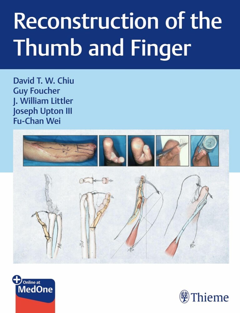 Reconstruction of the Thumb and Finger main product photo