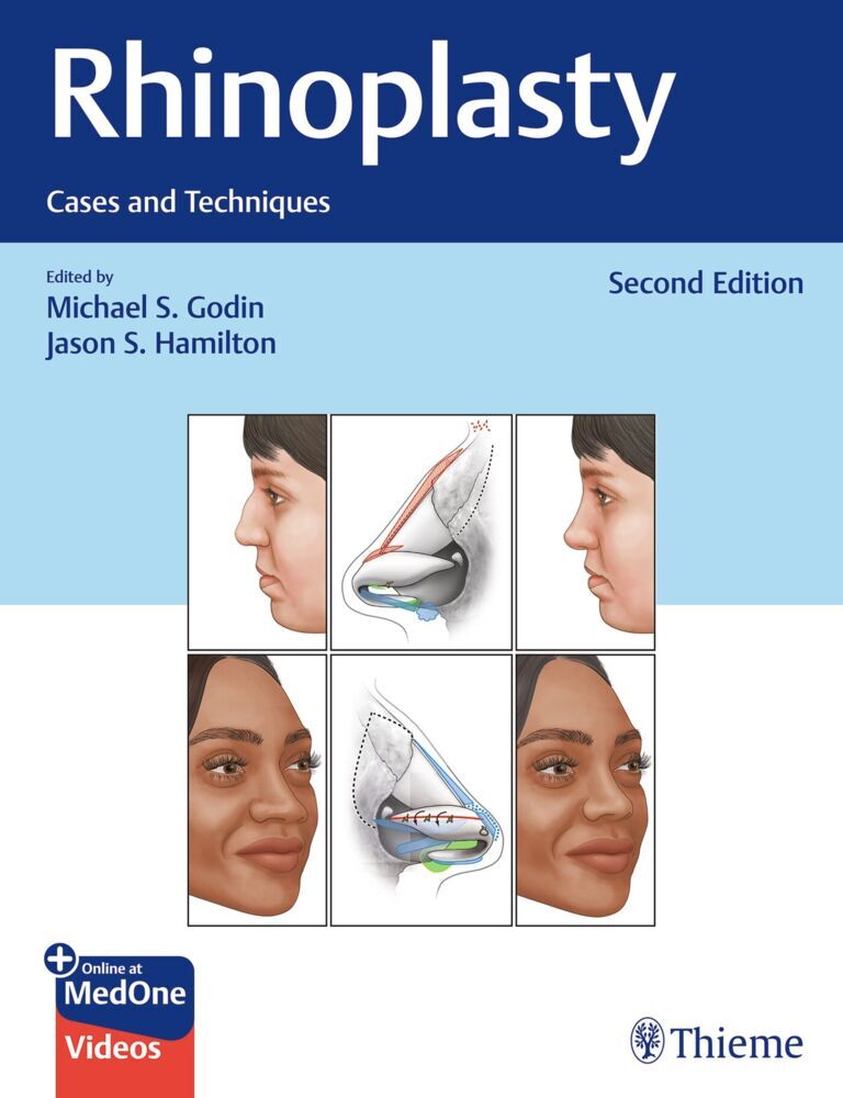 Rhinoplasty main product photo