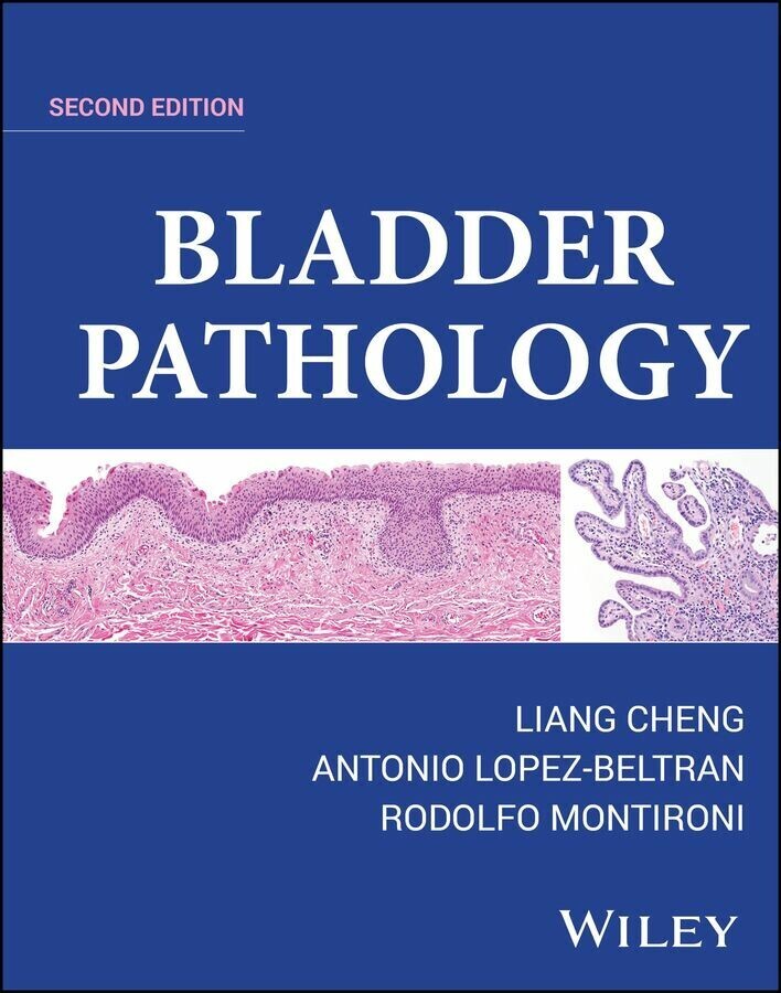 Bladder Pathology main product photo