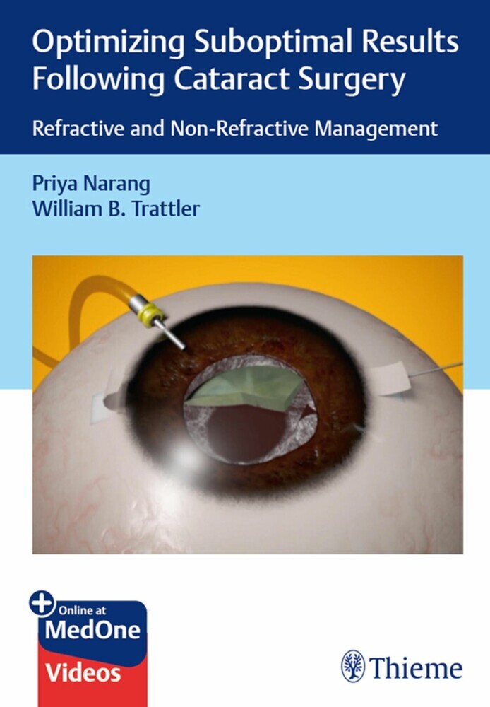 Optimizing Suboptimal Results Following Cataract Surgery main product photo