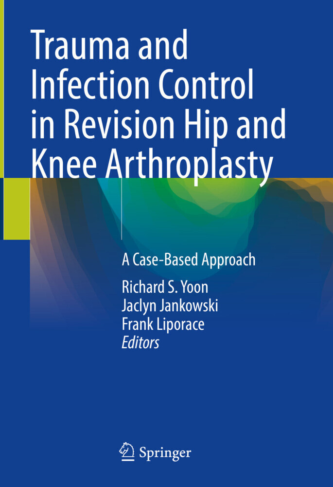 Trauma and Infection Control in Revision Hip and Knee Arthroplasty main product photo