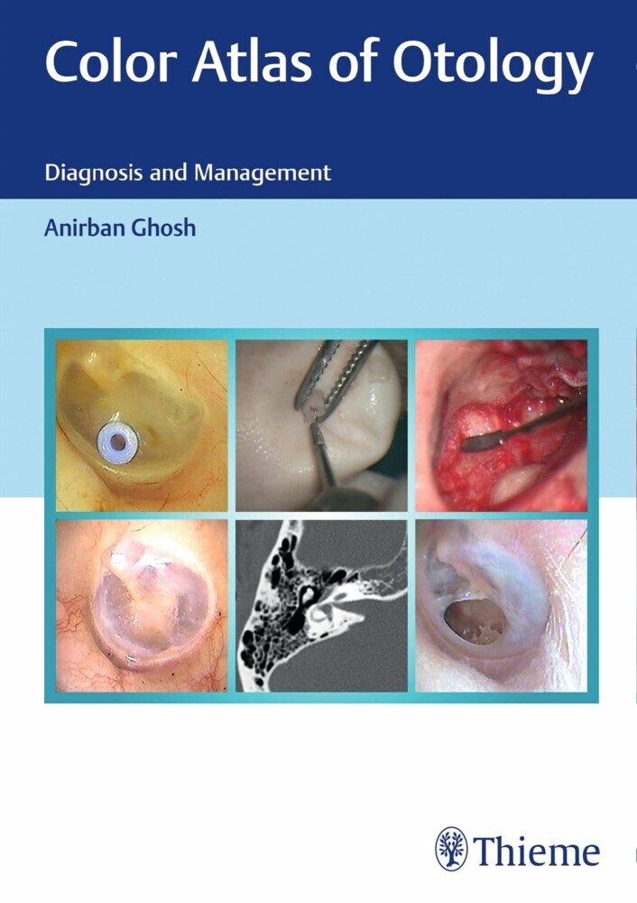 Color Atlas of Otology main product photo