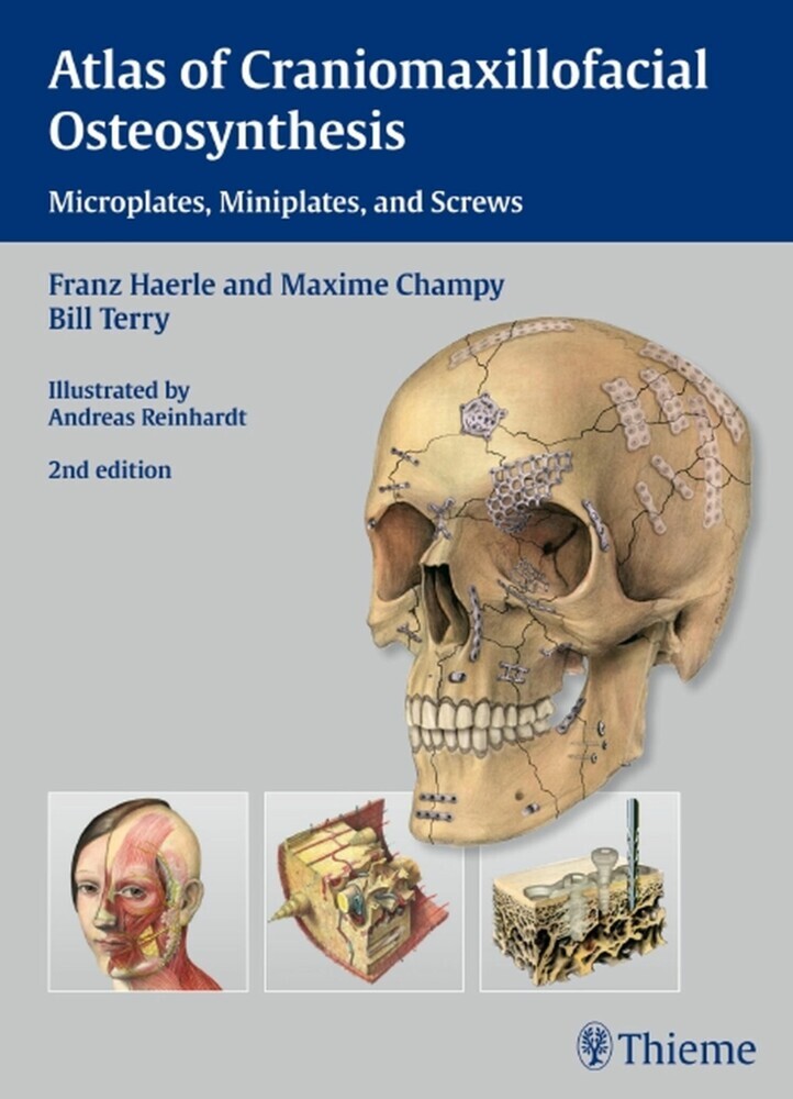 Atlas of Craniomaxillofacial Osteosynthesis main product photo