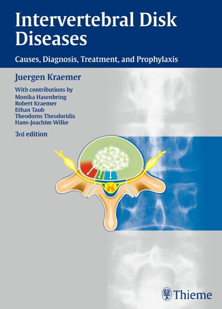 Intervertebral Disk Diseases main product photo