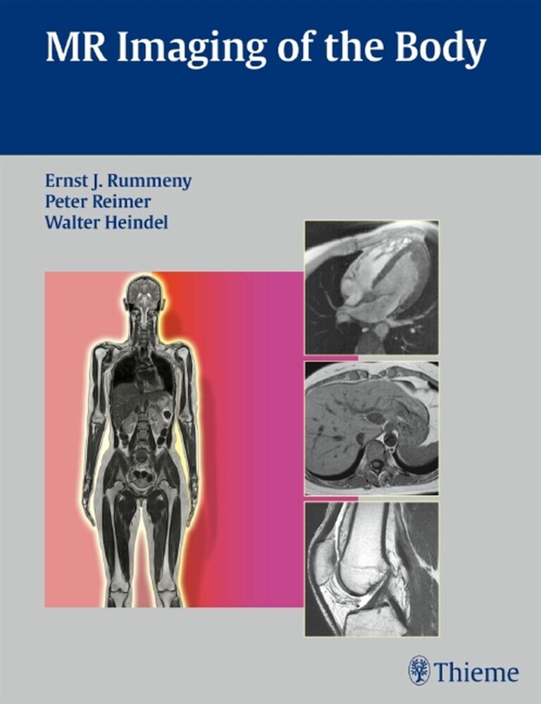 MR Imaging of the Body main product photo