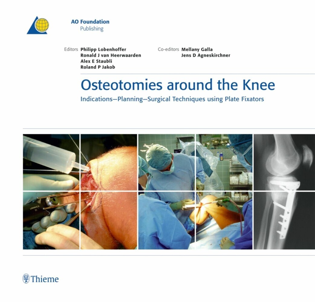 Osteotomies around the Knee main product photo