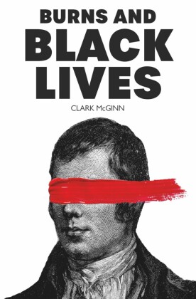 Burns and Black Lives