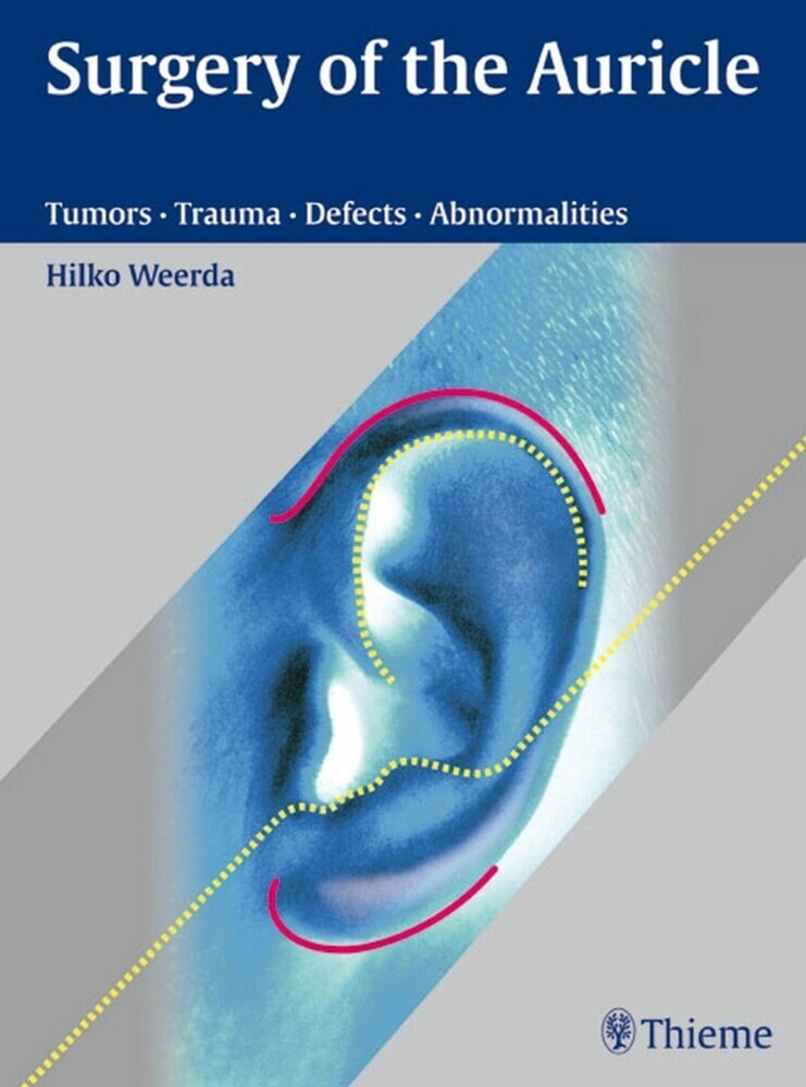 Surgery of the Auricle main product photo