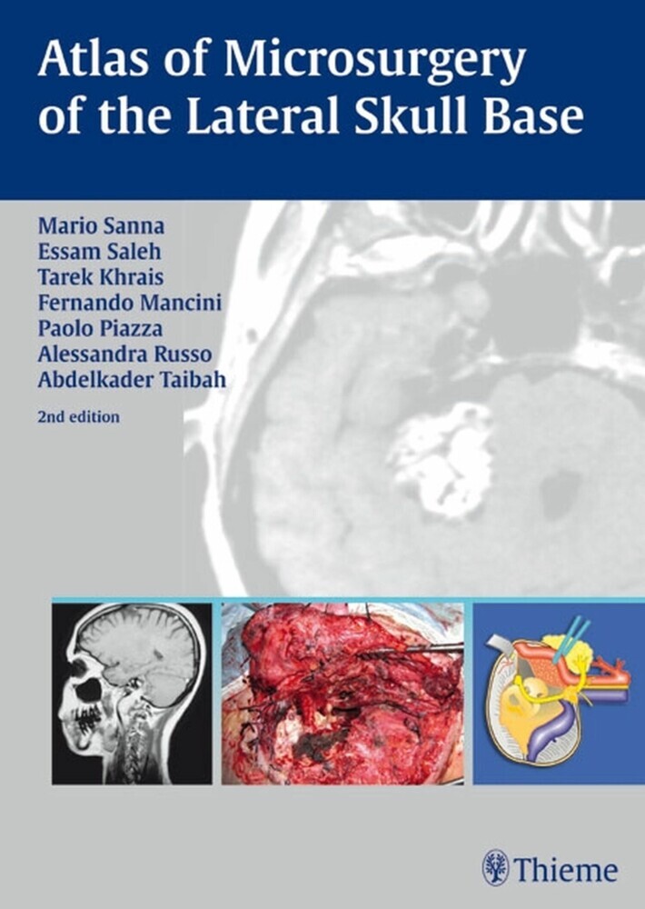 Atlas of Microsurgery of the Lateral Skull Base main product photo