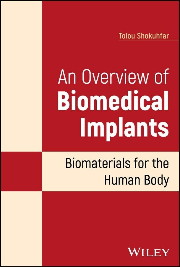 An Overview of Biomedical Implants main product photo