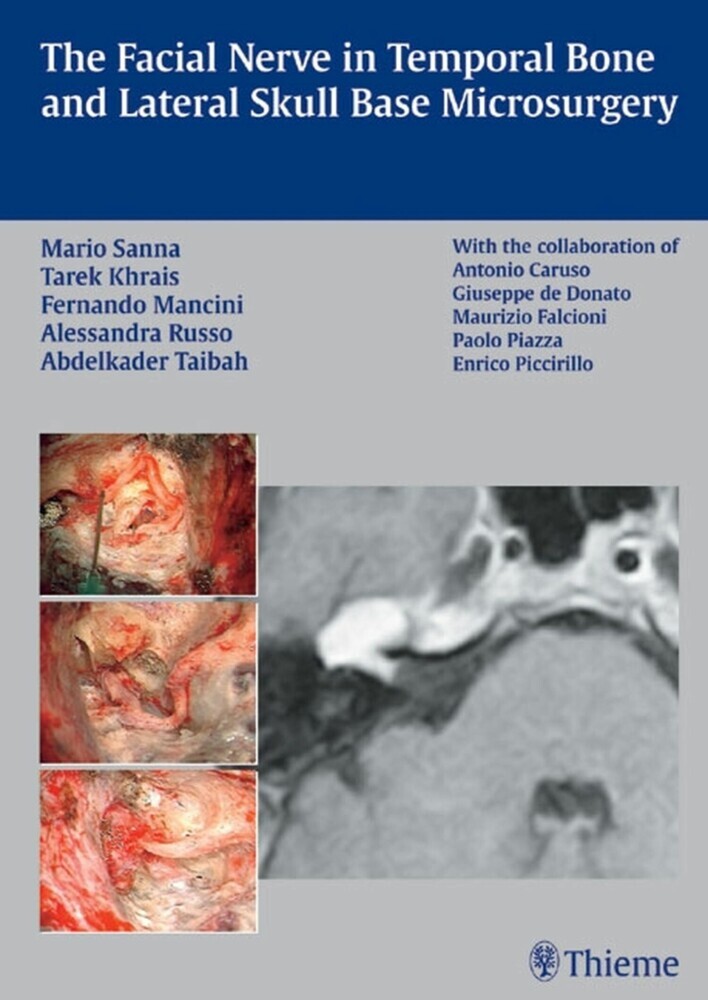 The Facial Nerve in Temporal Bone and Lateral Skull Base Microsurgery main product photo
