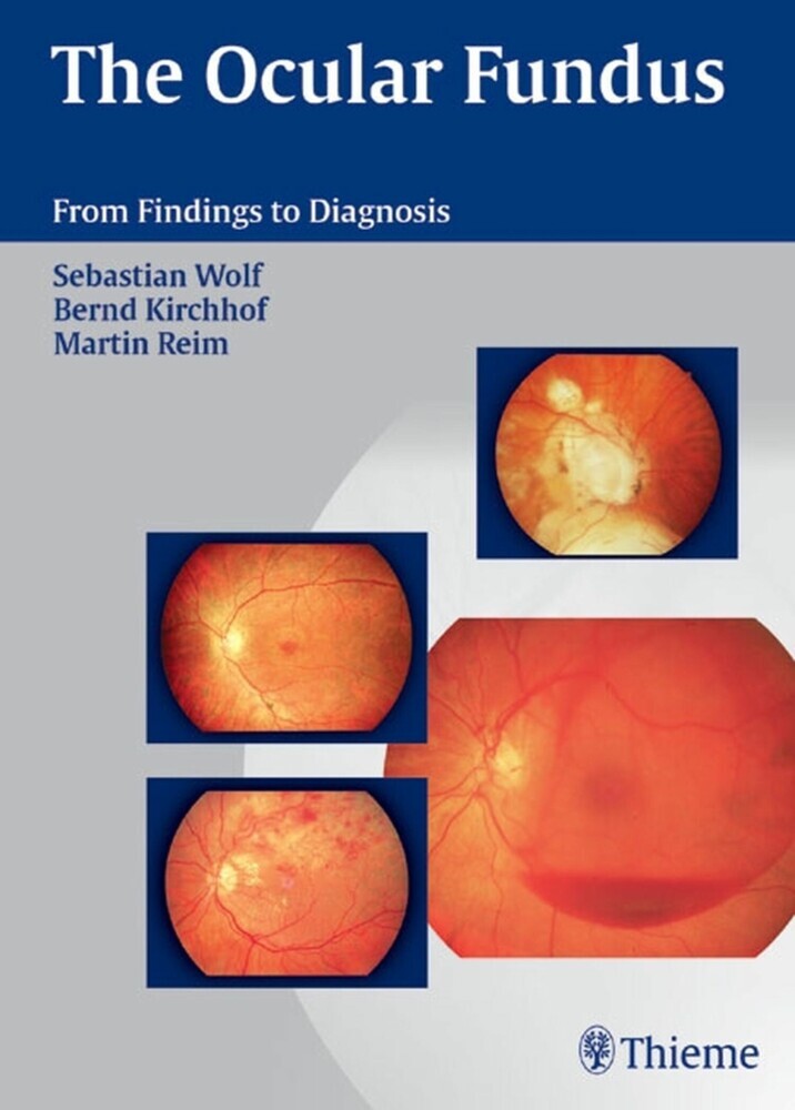 The Ocular Fundus main product photo