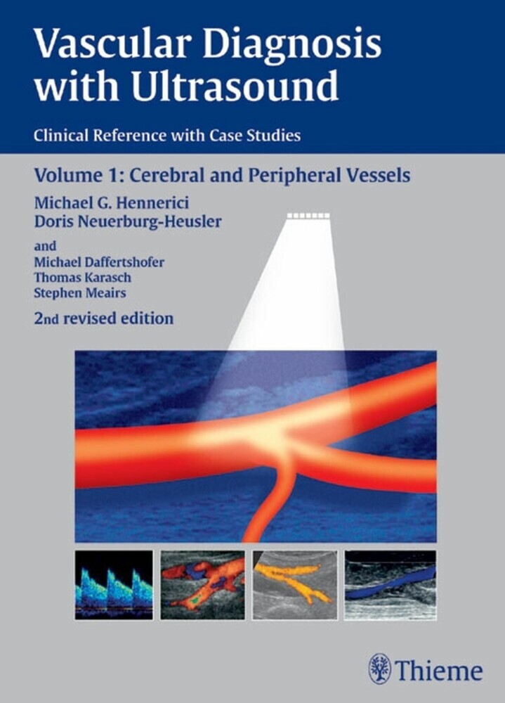 Vascular Diagnosis with Ultrasound main product photo