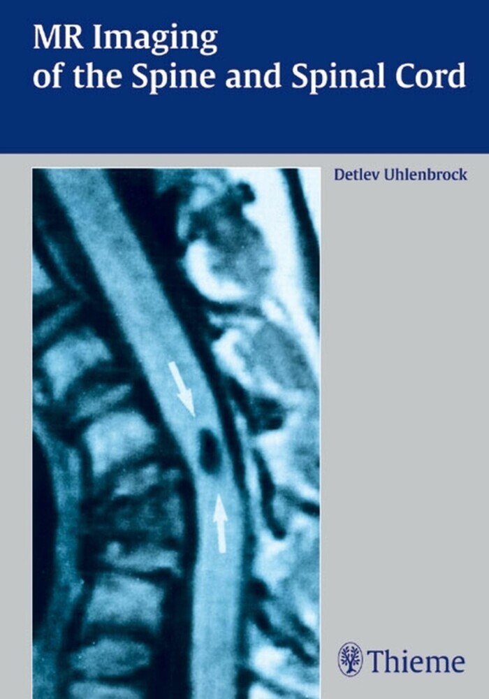 MR Imaging of the Spine and Spinal Cord main product photo