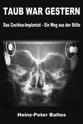 TAUB WAR GESTERN