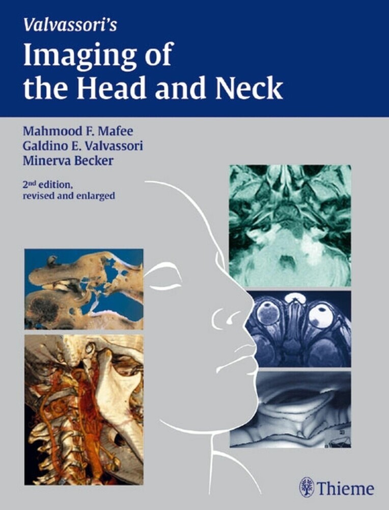Imaging of the Head and Neck main product photo
