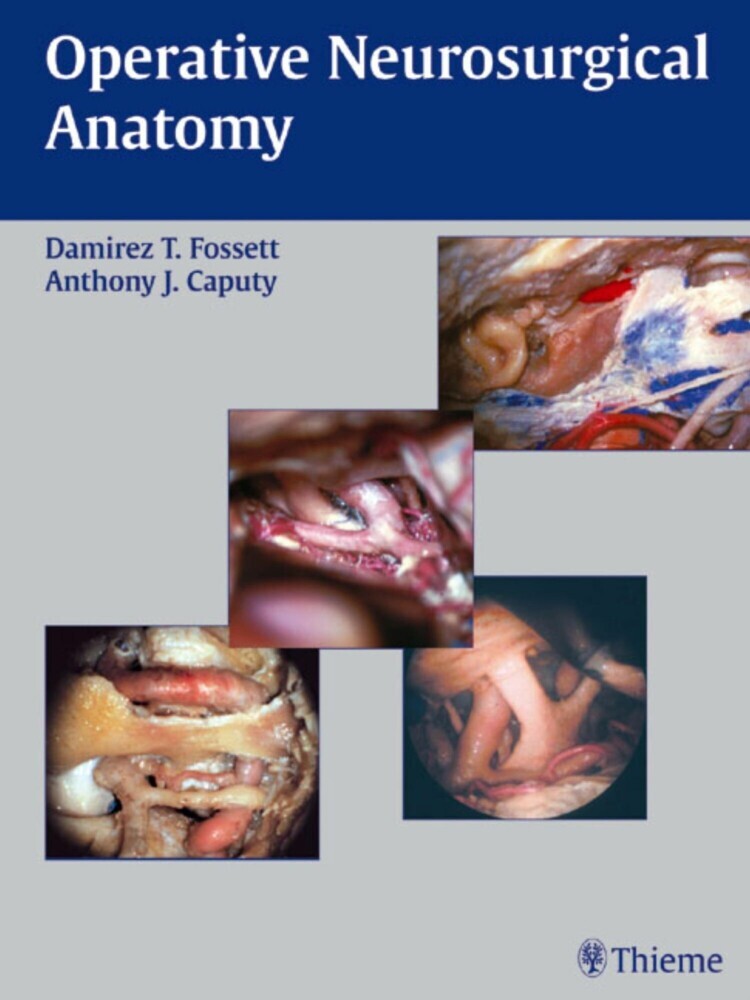 Operative Neurosurgical Anatomy main product photo