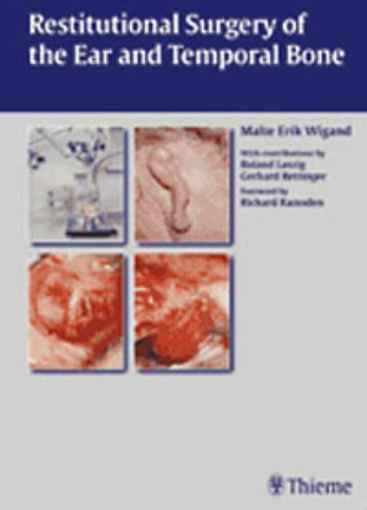 Restitutional Surgery of the Ear and Temporal Bone main product photo