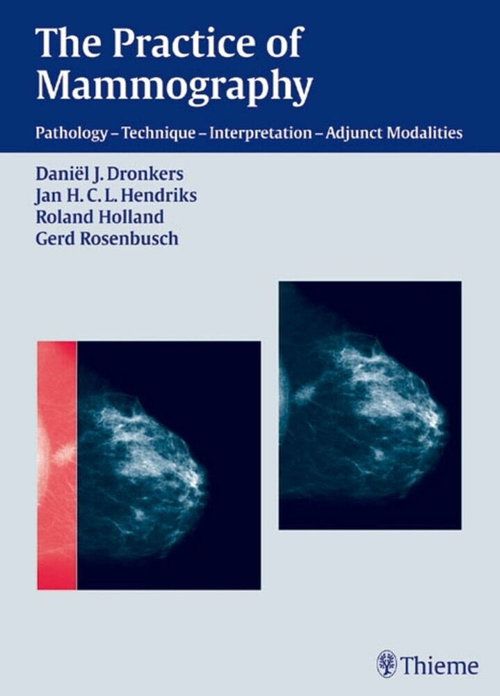 The Practice of Mammography main product photo