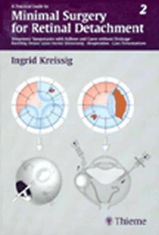 A Practical Guide to Minimal Surgery for Retinal Detachment, Vol. 2 main product photo