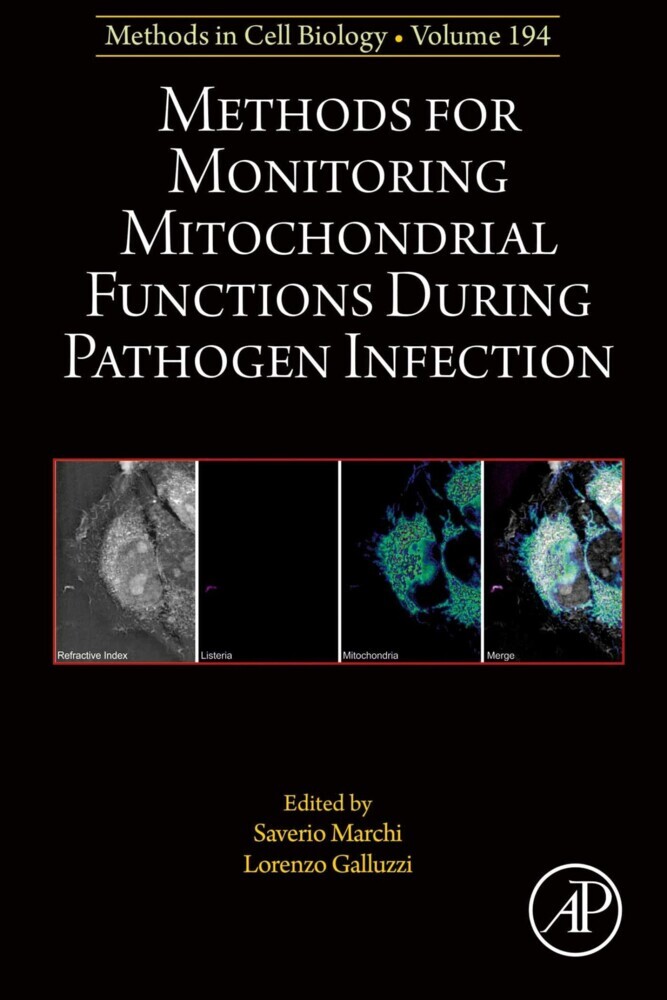Methods for Monitoring Mitochondrial Functions During Pathogen Infection main product photo