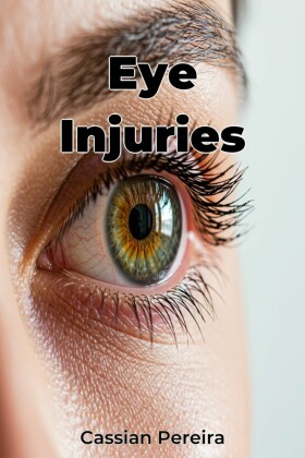 Eye Injuries