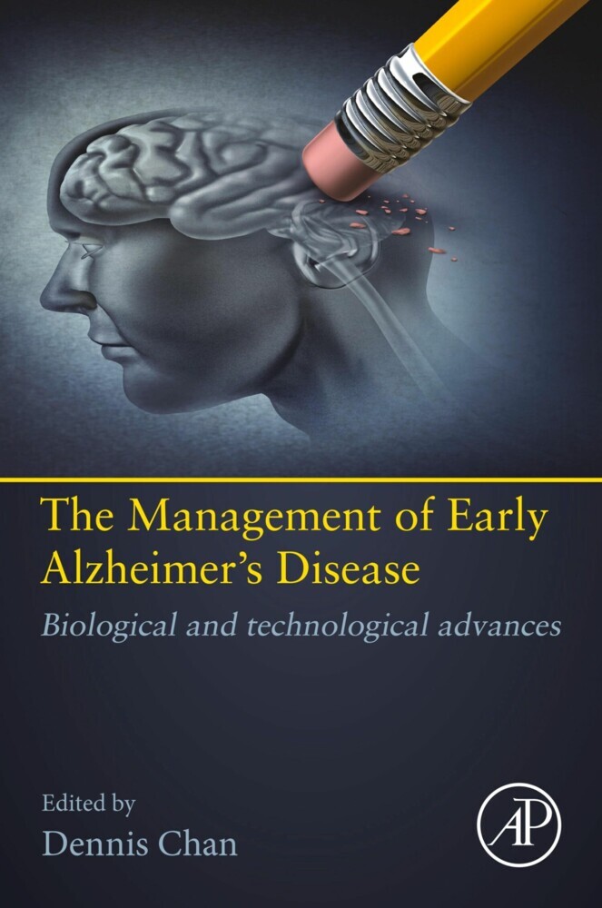 The management of early Alzheimer's disease main product photo