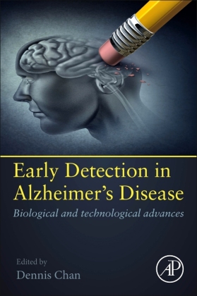 The management of early Alzheimer's disease