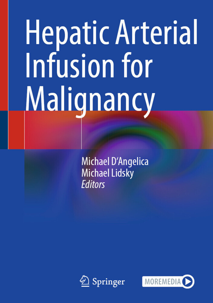 Hepatic Arterial Infusion for Malignancy main product photo