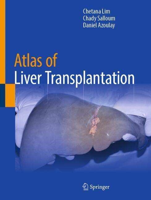 Atlas of Liver Transplantation main product photo