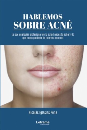 Hablemos sobre acné: 01 (Manual)