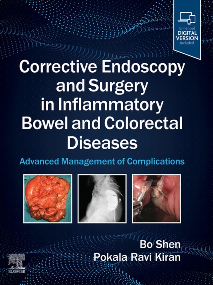Corrective Endoscopy and Surgery in Inflammatory Bowel and Colorectal Diseases - E-Book main product photo