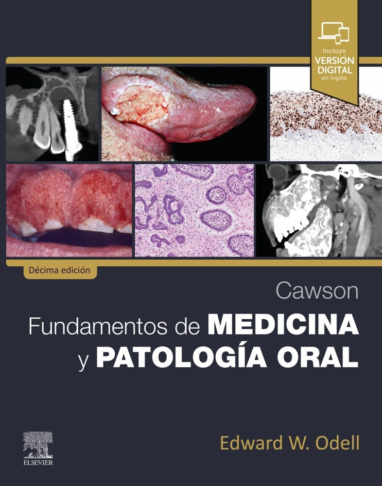 Cawson. Fundamentos de medicina y patología oral main product photo
