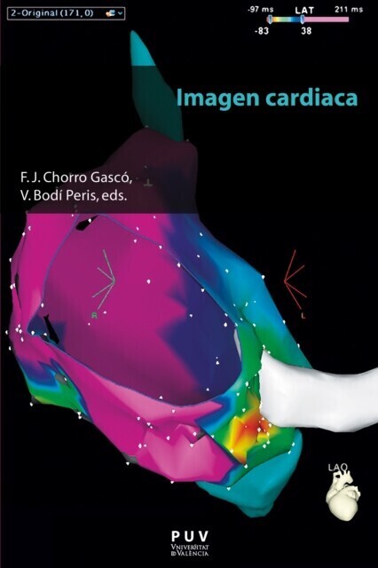 Imagen cardiaca main product photo