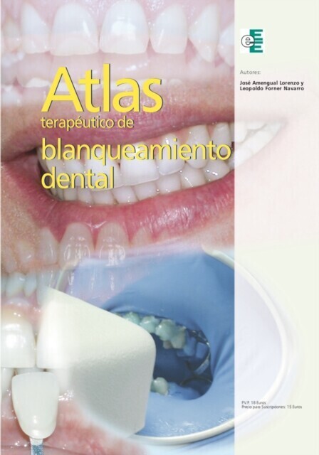 Atlas terapéutico de blanqueamiento dental main product photo