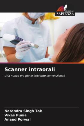 Scanner intraorali 
