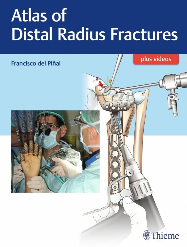 Atlas of Distal Radius Fractures main product photo