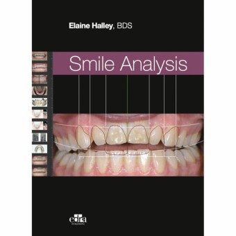 Smile Analysis