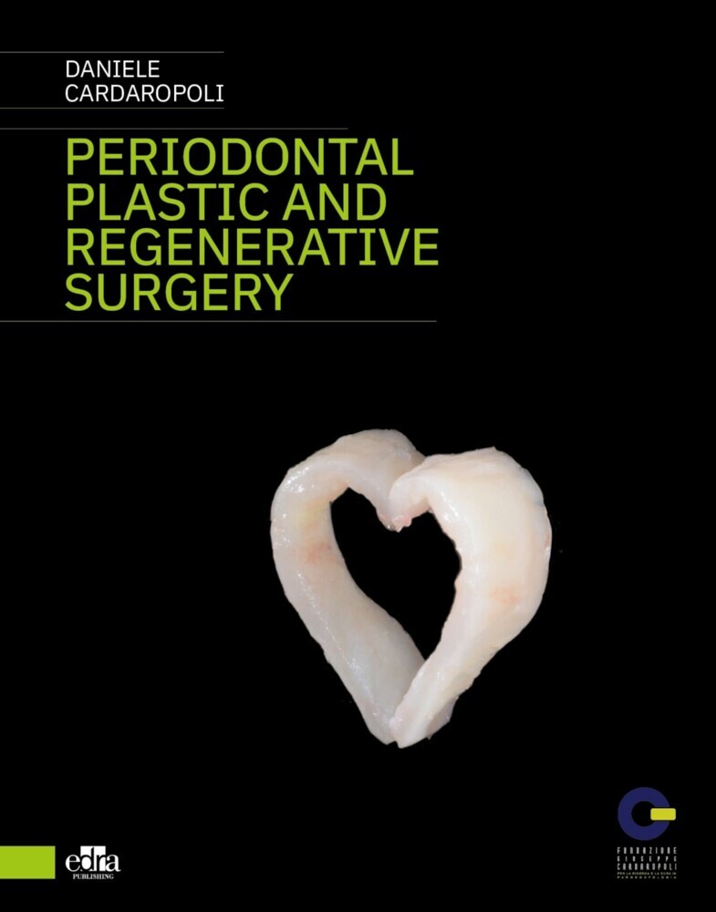 Peridontal plastic and regenerative surgery main product photo