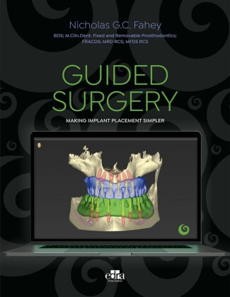 Guided surgery