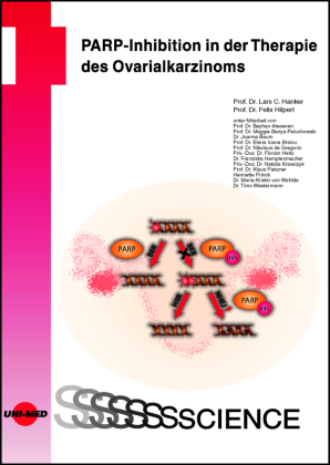 PARP-Inhibition in der Therapie des Ovarialkarzinoms