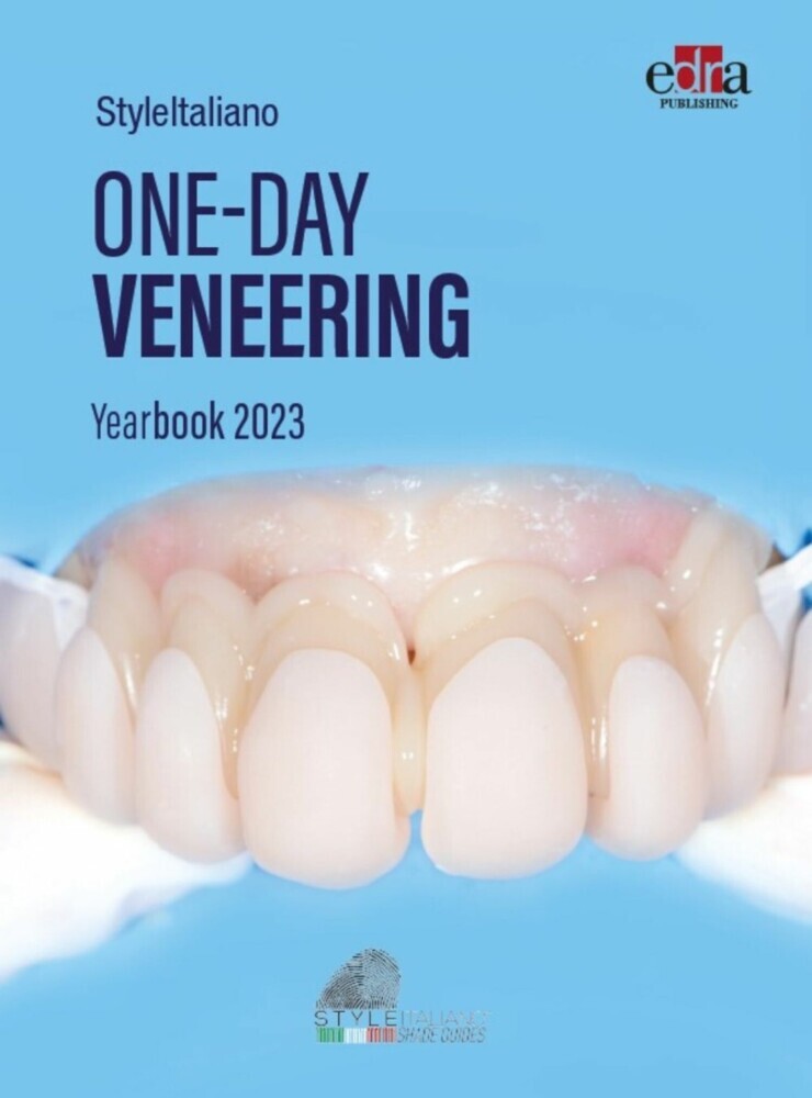 One-day Veneering main product photo