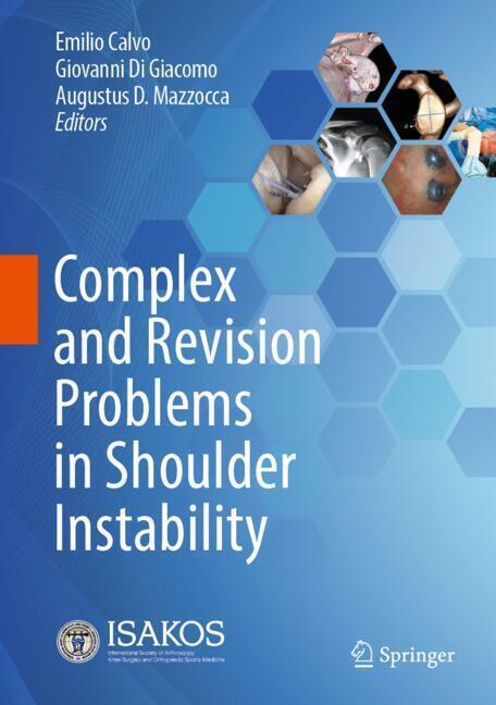 Complex and Revision Problems in Shoulder Instability main product photo