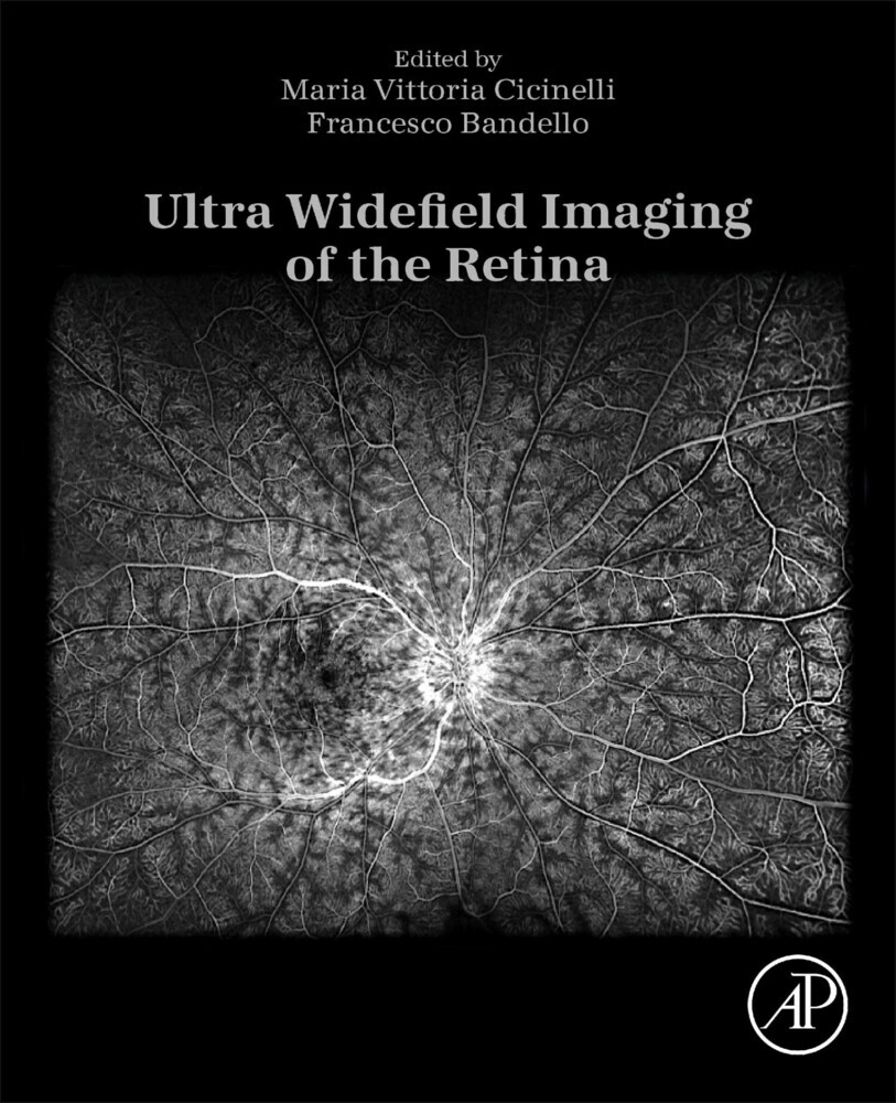 Ultra Widefield Imaging of the Retina main product photo