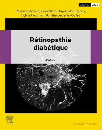 R'tinopathie diab'tique