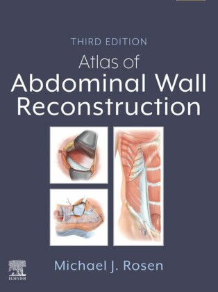 Atlas of Abdominal Wall Reconstruction - E-BOOK