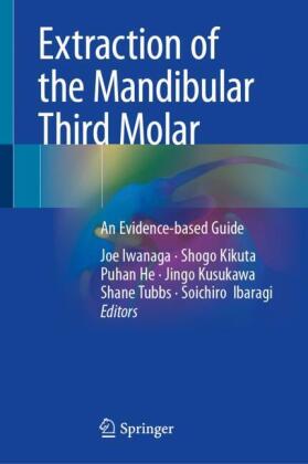 Extraction of the Mandibular Third Molar