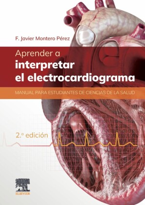 Aprender a interpretar el electrocardiograma